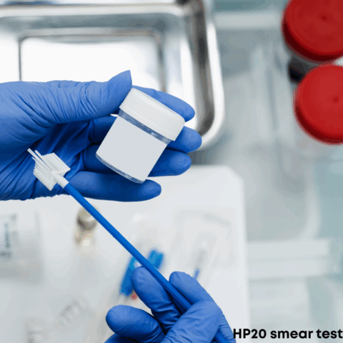 All you need to know about the HP20 smear test