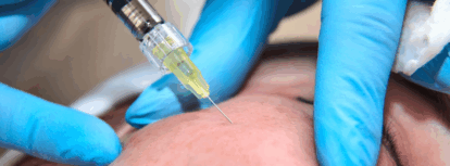 Aesthetic treatments should enhance your beauty, not change your identity. We combine clinical excellence with artistic subtlety and a commitment to safety. Whether you are seeking to reduce fine lines, rejuvenate your skin, or boost your natural radiance, our range of treatments is designed to provide results you’re comfortable with.