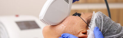 shutterstock_IPL_sm Our IPL treatments address common skin concerns such as pigmentation (sun spots, age spots), redness (broken capillaries, rosacea), and uneven skin tone. IPL uses multiple wavelengths of light to target pigmented cells and vascular lesions beneath the skin surface, promoting clearer, more uniform skin.